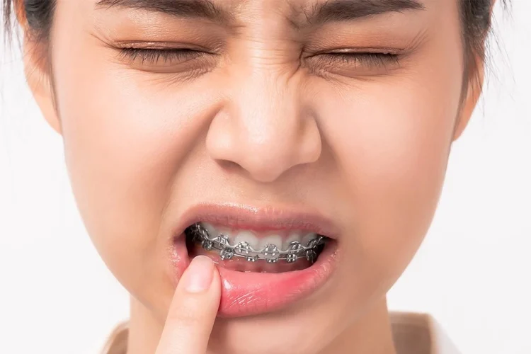 آیا ارتودنسی دندان درد دارد